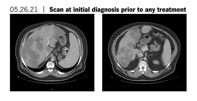 Scans prior to treatment